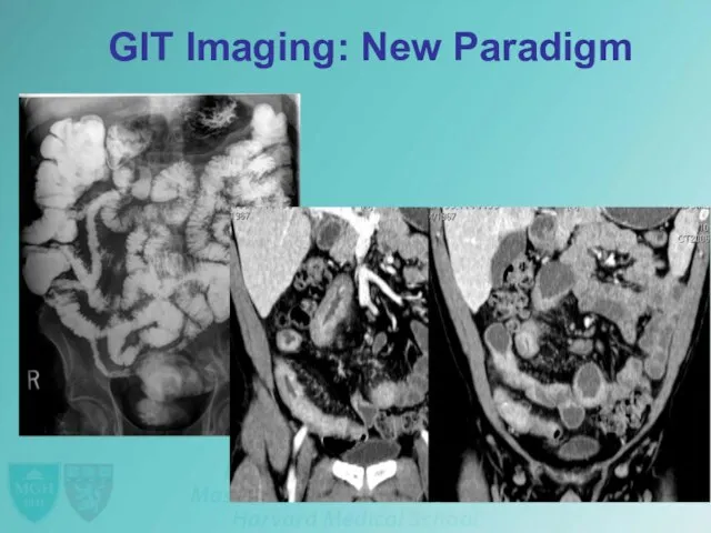 GIT Imaging: New Paradigm