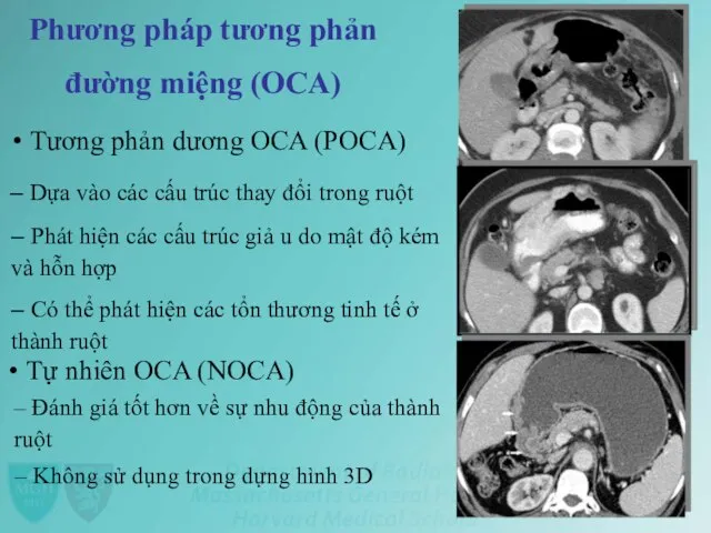 Phương pháp tương phản đường miệng (OCA) • Tương phản dương