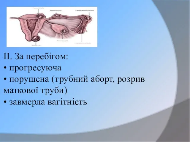 ІІ. За перебігом: • прогресуюча • порушена (трубний аборт, розрив маткової труби) • завмерла вагітність