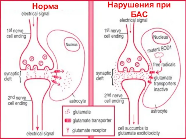 Норма Нарушения при БАС