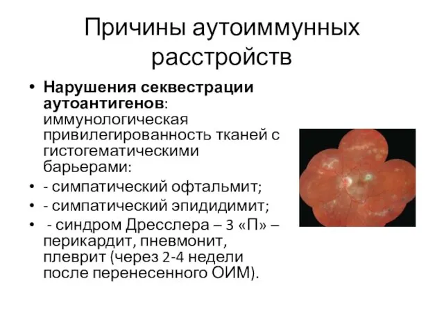 Причины аутоиммунных расстройств Нарушения секвестрации аутоантигенов: иммунологическая привилегированность тканей с гистогематическими