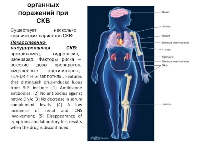 Характер органных поражений при СКВ Существует несколько клинических вариантов СКВ: Лекарственно-индуцированная