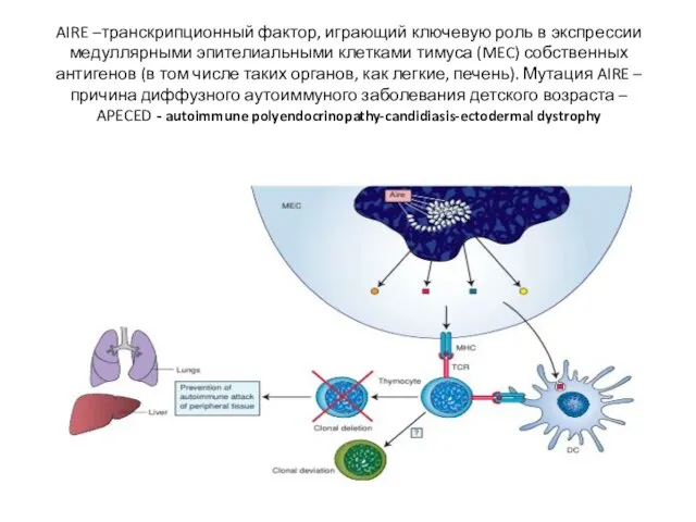 AIRE –транскрипционный фактор, играющий ключевую роль в экспрессии медуллярными эпителиальными клетками