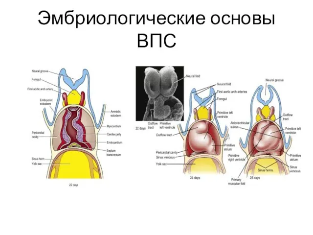 Эмбриологические основы ВПС