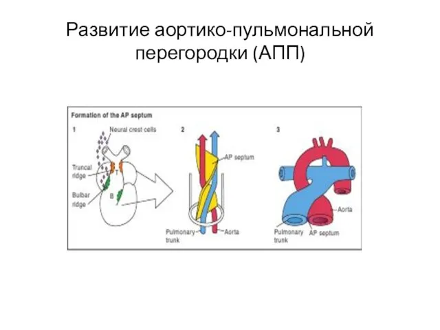 Развитие аортико-пульмональной перегородки (АПП)