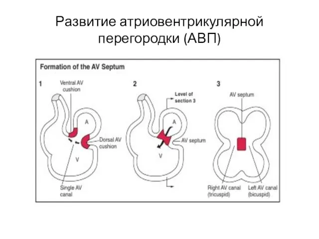 Развитие атриовентрикулярной перегородки (АВП)