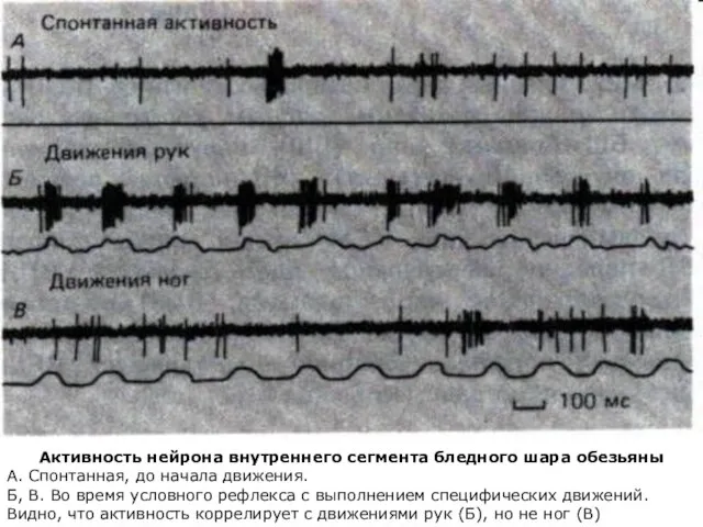 Активность нейрона внутреннего сегмента бледного шара обезьяны А. Спонтанная, до начала