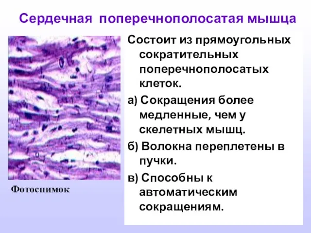 Сердечная поперечнополосатая мышца Состоит из прямоугольных сократительных поперечнополосатых клеток. а) Сокращения