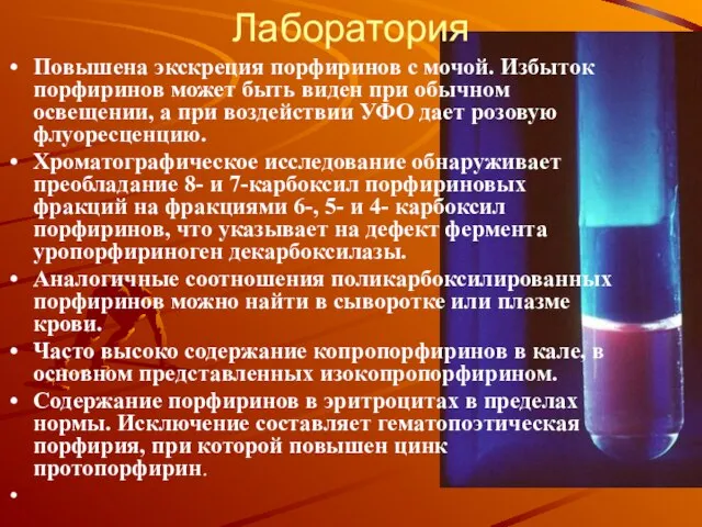 Повышена экскреция порфиринов с мочой. Избыток порфиринов может быть виден при