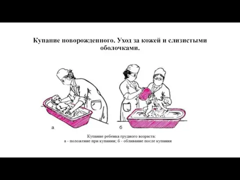 Купание новорожденного. Уход за кожей и слизистыми оболочками.