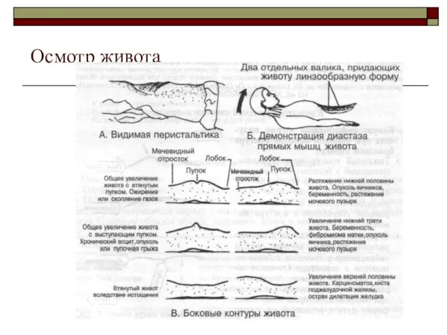 Осмотр живота