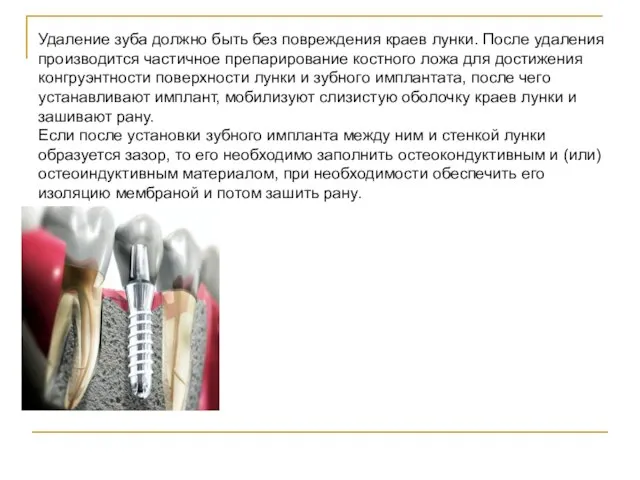 Удаление зуба должно быть без повреждения краев лунки. После удаления производится