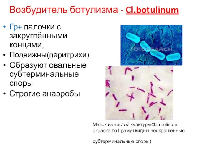 Мазок из чистой культурыCl.botulinum окраска по Граму (видны неокрашенные субтерминальные споры)