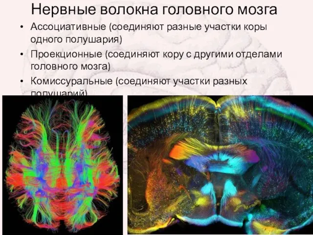 Нервные волокна головного мозга Ассоциативные (соединяют разные участки коры одного полушария)