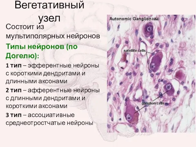 Вегетативный узел Состоит из мультиполярных нейронов Типы нейронов (по Догелю): 1