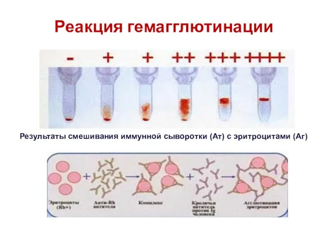 Реакция гемагглютинации Результаты смешивания иммунной сыворотки (Ат) с эритроцитами (Аг)