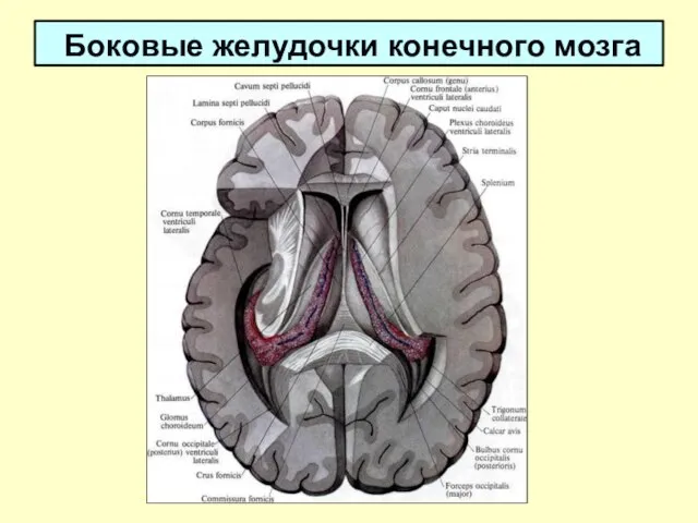 Боковые желудочки конечного мозга