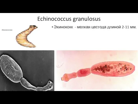 Echinococcus granulosus Эхинококк - мелкая цестода длиной 2-11 мм.
