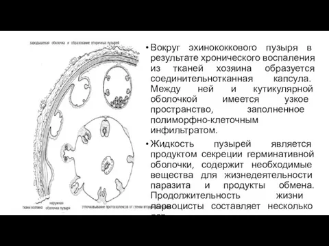 Вокруг эхинококкового пузыря в результате хронического воспаления из тканей хозяина образуется