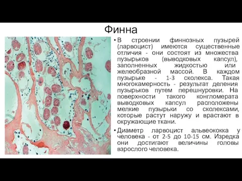 Финна В строении финнозных пузырей (ларвоцист) имеются существенные отличия - они