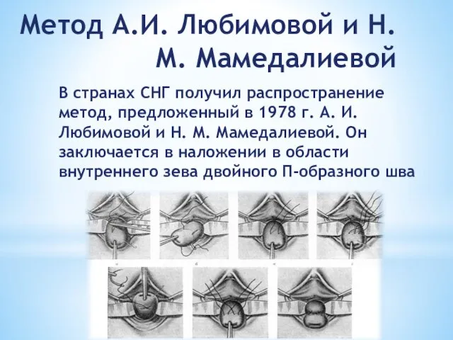 В странах СНГ получил распространение метод, предложенный в 1978 г. А.