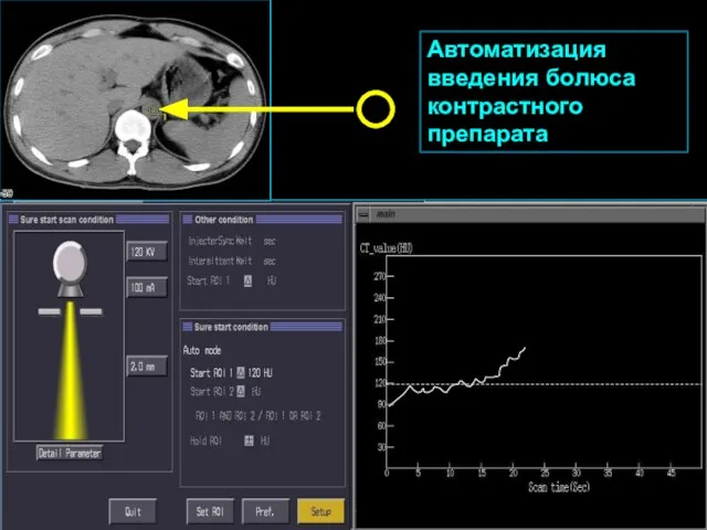 Автоматизация введения болюса контрастного препарата