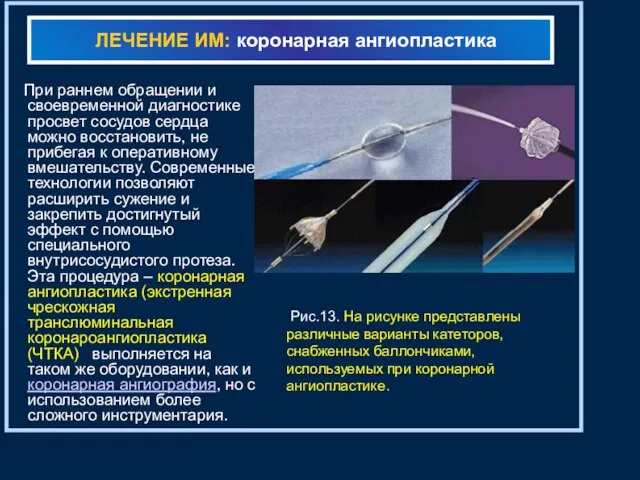 ЛЕЧЕНИЕ ИМ: коронарная ангиопластика При раннем обращении и своевременной диагностике просвет