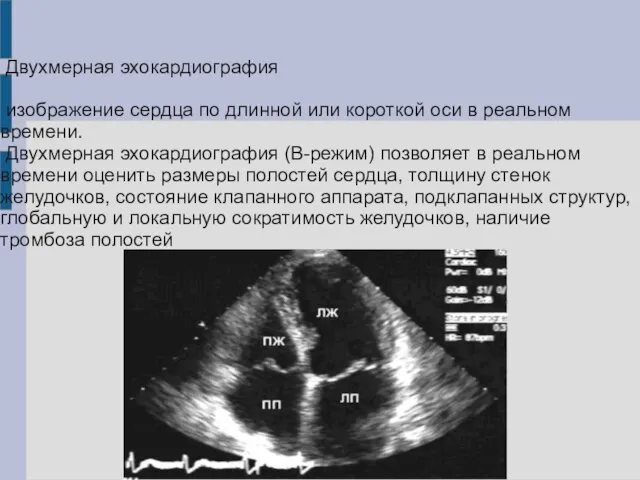 Двухмерная эхокардиография изображение сердца по длинной или короткой оси в реальном