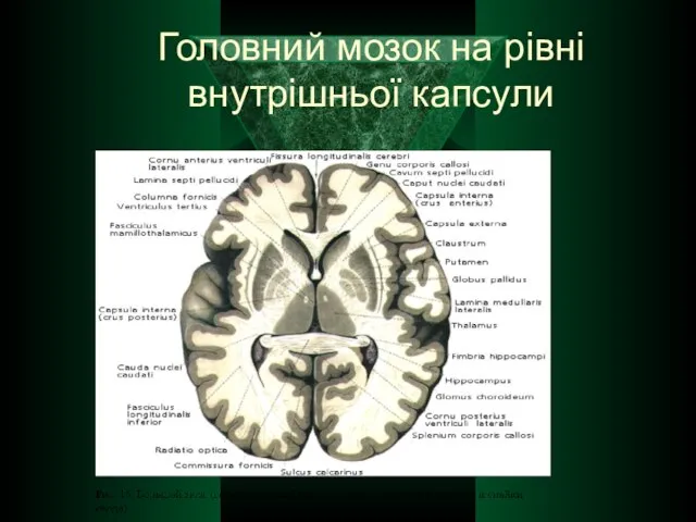 Головний мозок на рівні внутрішньої капсули