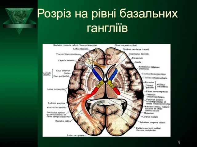 Розріз на рівні базальних гангліїв