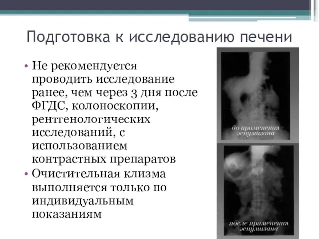 Подготовка к исследованию печени Не рекомендуется проводить исследование ранее, чем через