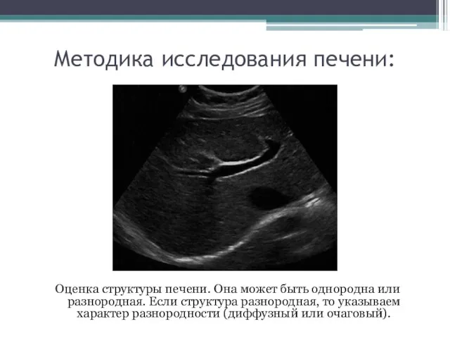 Методика исследования печени: Оценка структуры печени. Она может быть однородна или