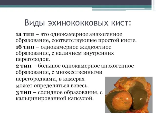 Виды эхинококковых кист: 1а тип – это однокамерное анэхогенное образование, соответствующее