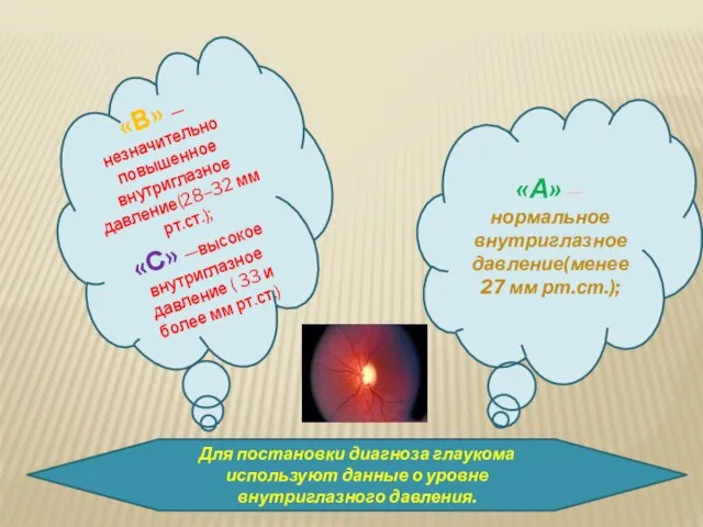 Для постановки диагноза глаукома используют данные о уровне внутриглазного давления. «А»