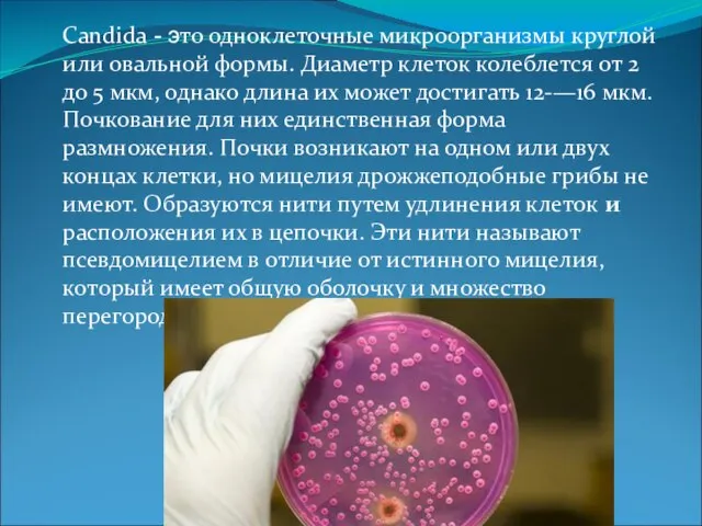 Candida - это одноклеточные микроорганизмы круглой или овальной формы. Диаметр клеток