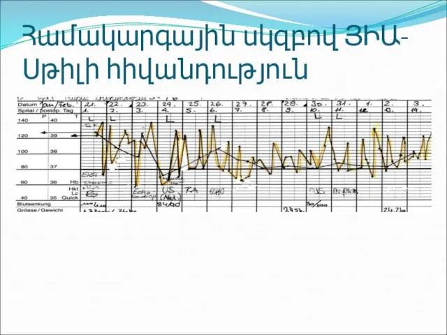 Համակարգային սկզբով ՅԻԱ-Սթիլի հիվանդություն