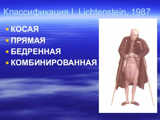 Классификация I. Lichtenstein, 1987 КОСАЯ ПРЯМАЯ БЕДРЕННАЯ КОМБИНИРОВАННАЯ