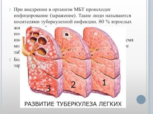 При внедрении в организм МБТ происходит инфицирование (заражение). Такие люди называются