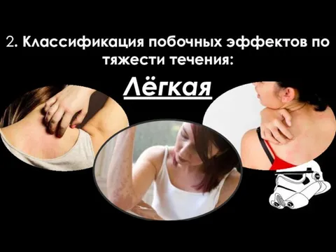 2. Классификация побочных эффектов по тяжести течения: Лёгкая