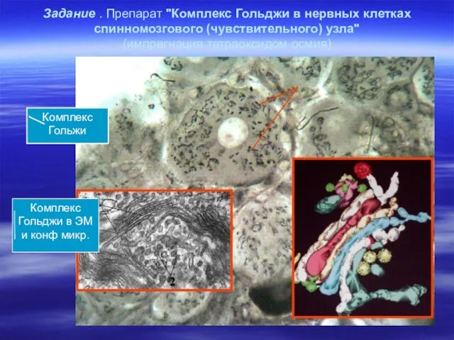 Задание . Препарат "Комплекс Гольджи в нервных клетках спинномозгового (чувствительного) узла"