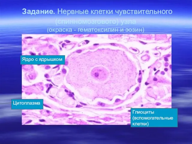 Задание. Нервные клетки чувствительного (спинномозгового) узла (окраска - гематоксилин и эозин)