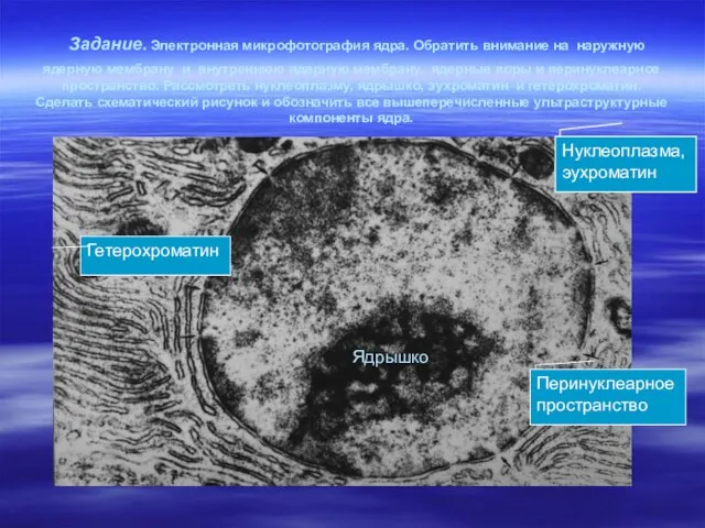 Задание. Электронная микрофотография ядра. Обратить внимание на наружную ядерную мембрану и