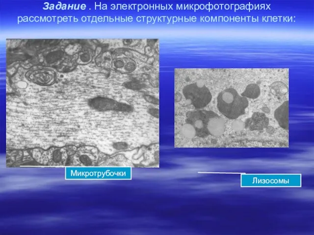 Задание . На электронных микрофотографиях рассмотреть отдельные структурные компоненты клетки: Лизосомы Микротрубочки