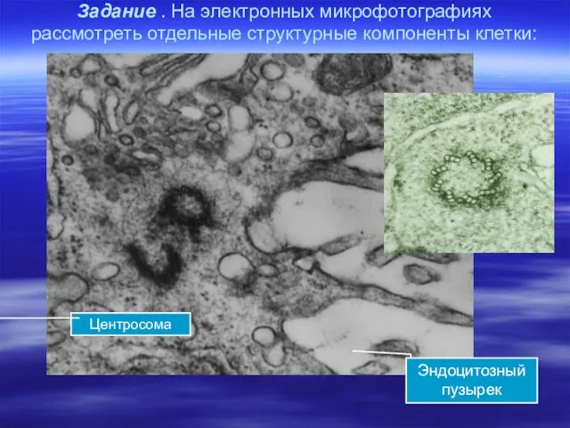 Задание . На электронных микрофотографиях рассмотреть отдельные структурные компоненты клетки: Эндоцитозный пузырек Центросома