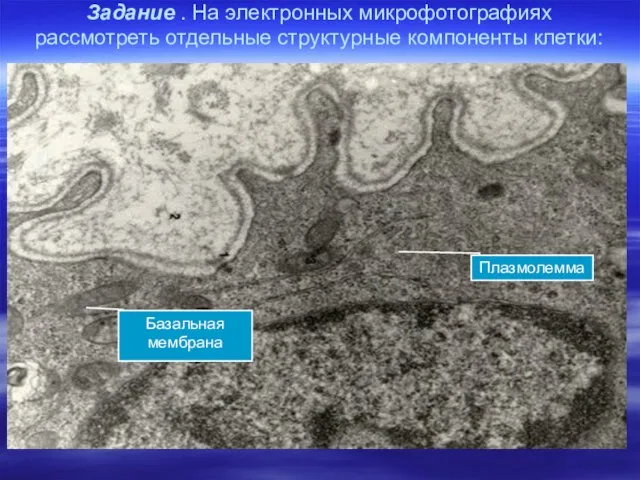 Задание . На электронных микрофотографиях рассмотреть отдельные структурные компоненты клетки: Плазмолемма Базальная мембрана