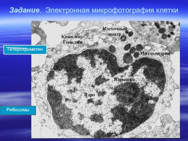 Задание. Электронная микрофотография клетки Рибосомы Гетерохроматин