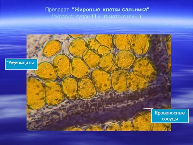 Препарат "Жировые клетки сальника" (окраска: судан-III и гематоксилин ) Кровеносные сосуды Адипоциты