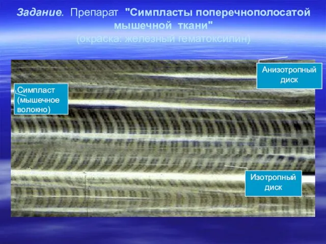 Задание. Препарат "Симпласты поперечнополосатой мышечной ткани" (окраска: железный гематоксилин) Анизотропный диск Изотропный диск Симпласт (мышечное волокно)
