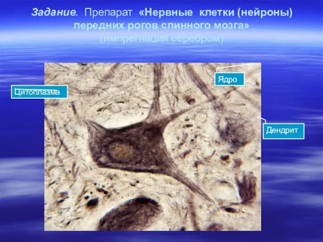 Задание. Препарат «Нервные клетки (нейроны) передних рогов спинного мозга» (импрегнация серебром) Ядро Дендрит Цитоплазма