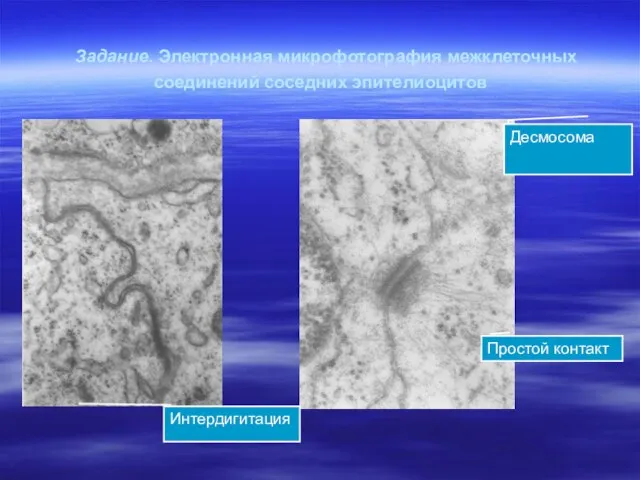 Задание. Электронная микрофотография межклеточных соединений соседних эпителиоцитов Десмосома Простой контакт Интердигитация